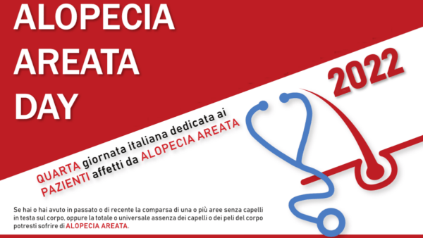 Alopecia Areata Day: visite dermatologiche gratuite negli ambulatori catanesi (DOVE E QUANDO)