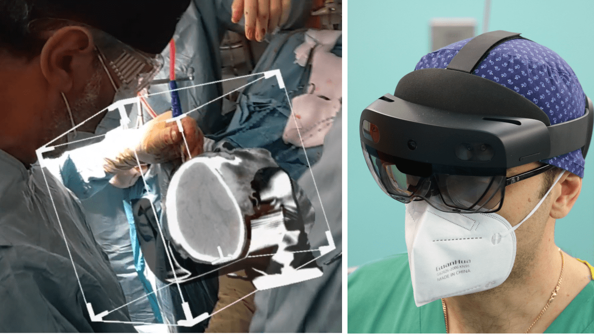 Cominciano i test della realtà aumentata: ologrammi in Neurochirurgia all’Ospedale Cannizzaro