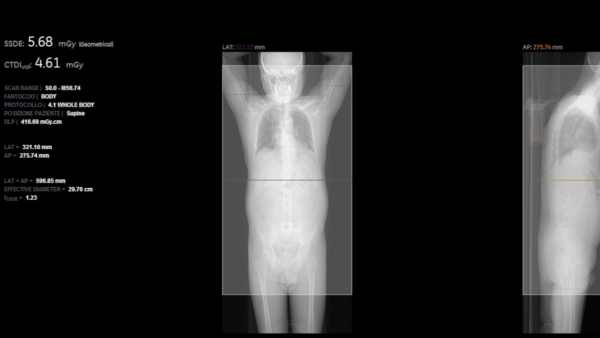 Nuovo sistema per preservare la salute di chi effettua esami radiologici all’ospedale Cannizzaro