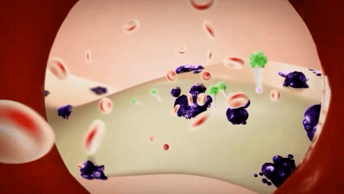 Tumore della prostata: nuovo radiofarmaco “Fluoro-PSMA” utilizzato all’ospedale Cannizzaro (VIDEO E DETTAGLI)
