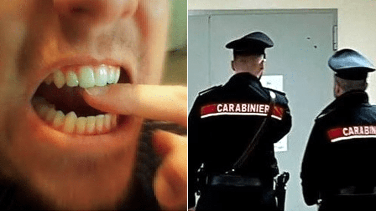 Figlio Stacca Dito Padre Morso Carabinieri Finta Rapina Mascalucia