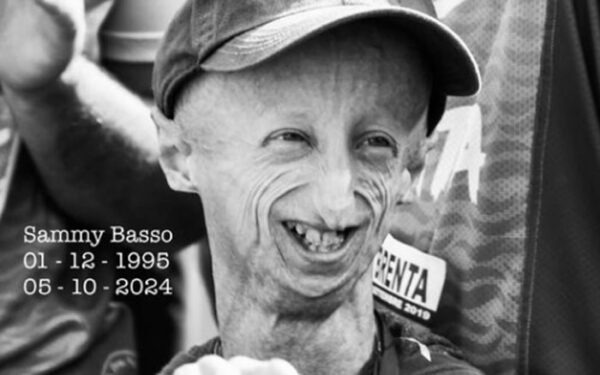 Un giovane malato di progeria muore a 28 anni | La sua vita dedicata alla ricerca ci fa riflettere sull'importanza della resilienza