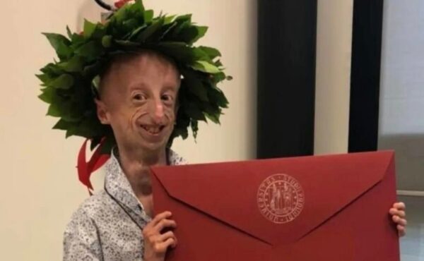 Un ministero italiano intitolerà una scuola a un giovane affetto da progeria | Scopri perché la sua storia sta cambiando il volto dell'istruzione!