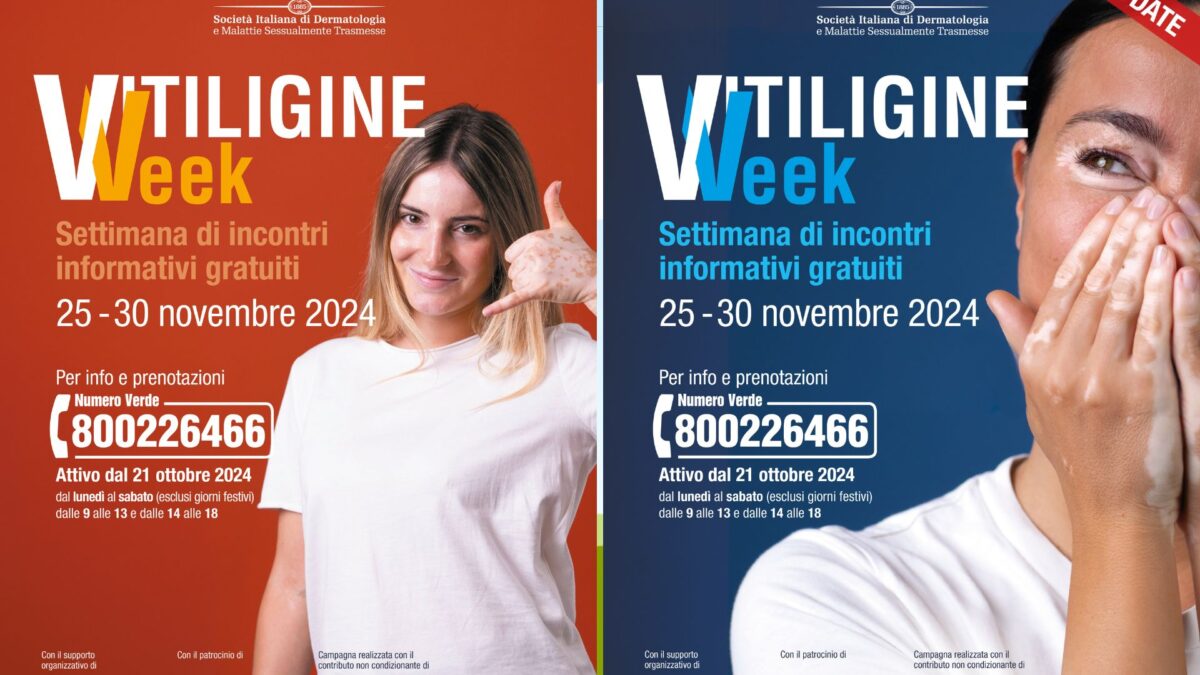 La ‘Vitiligine Week’ in Sicilia | Scopri perché questa malattia è molto più di una semplice condizione estetica!