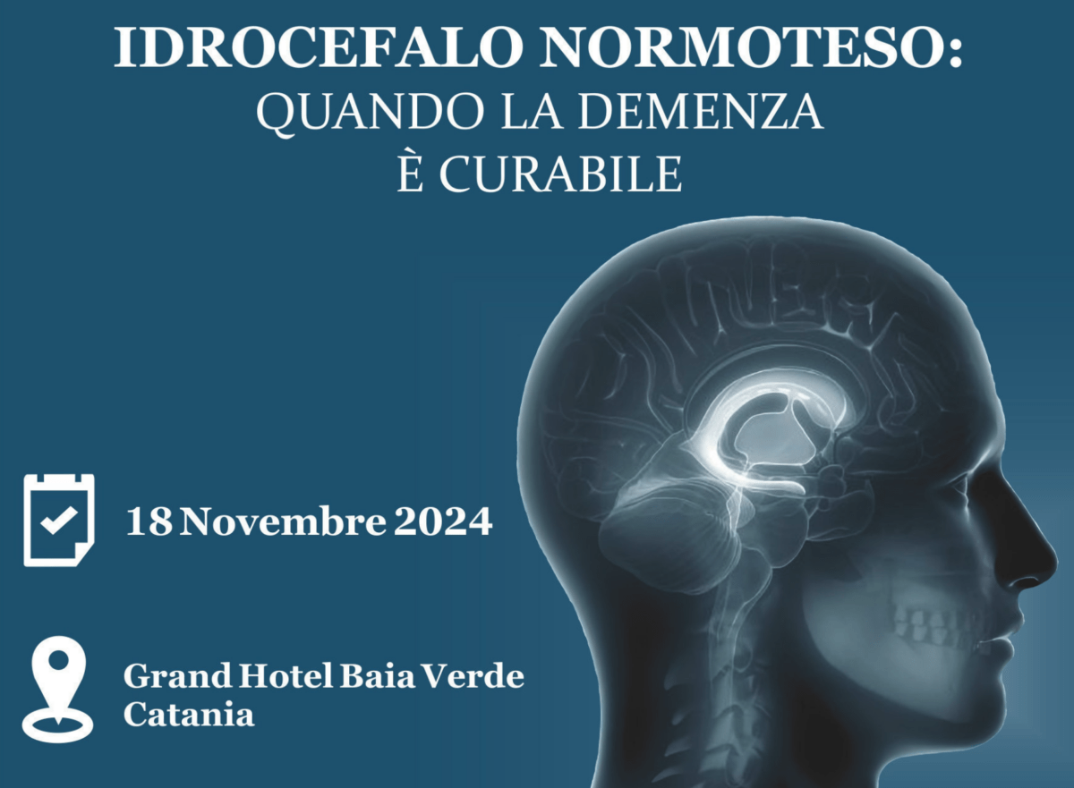 Idrocefalo normoteso: la verità che i medici non vogliono dirti | Scopri perché questa malattia potrebbe essere la chiave per curare la demenza!